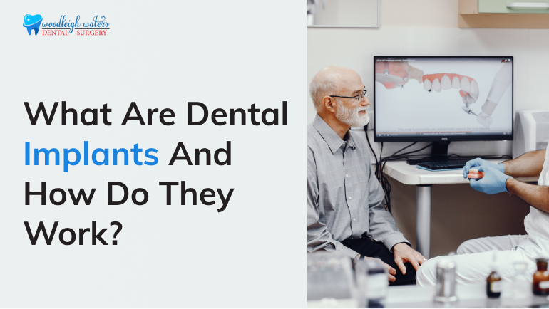 Dental Implants