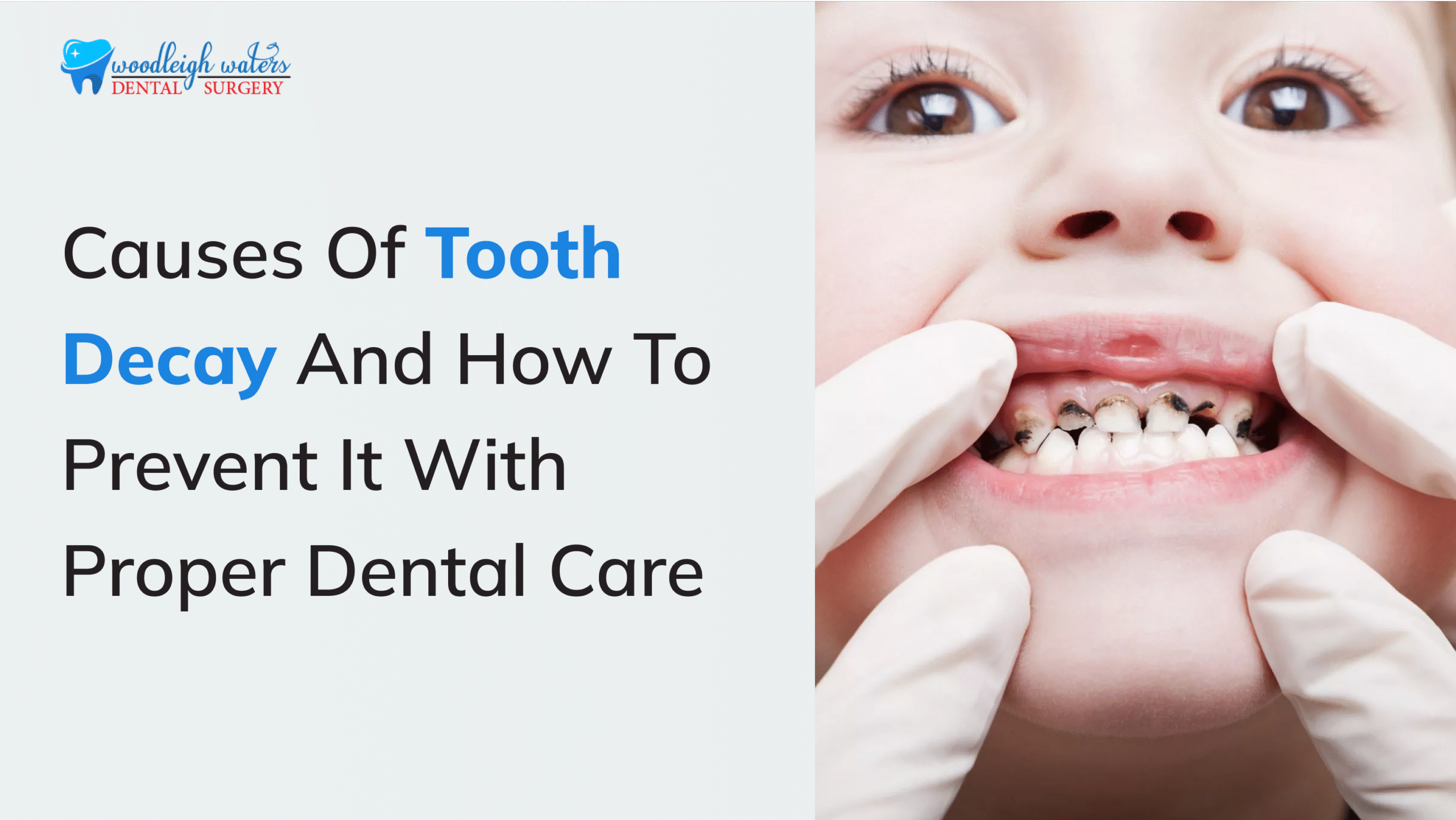 tooth decay berwick
