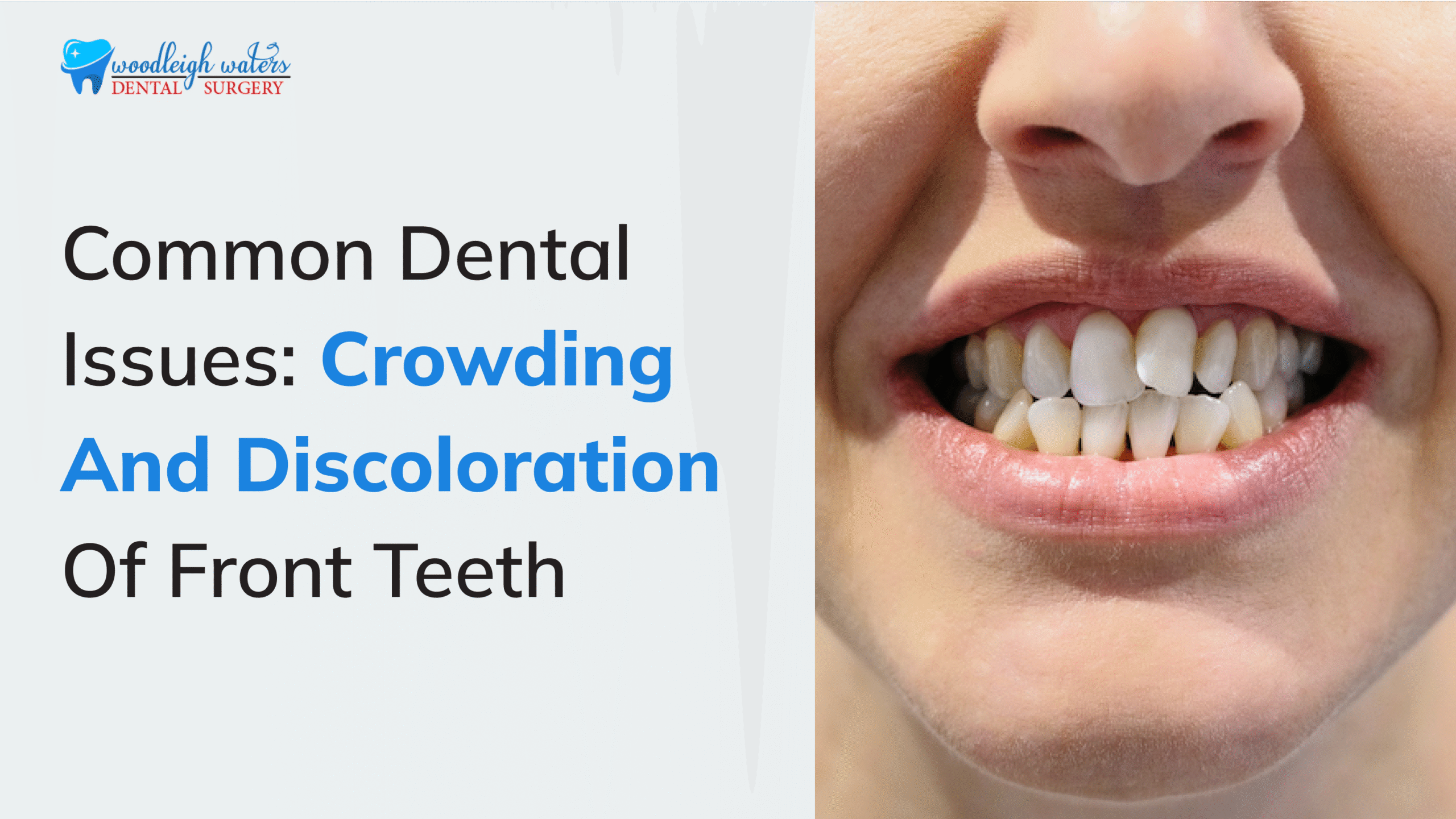 dental problem Berwick