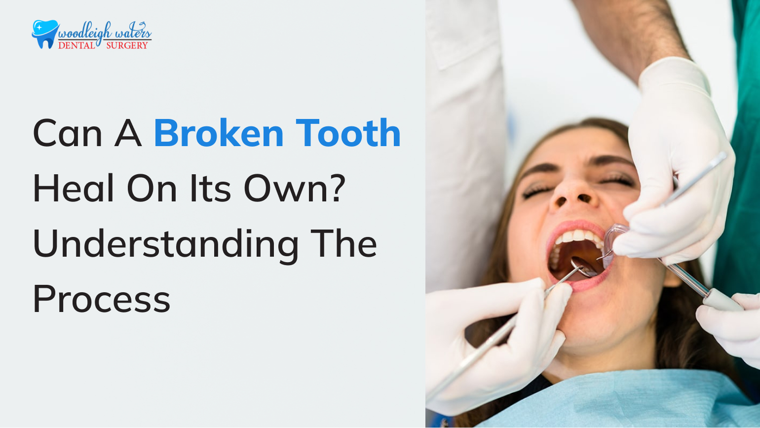 Can a Broken Tooth Heal on Its Own?