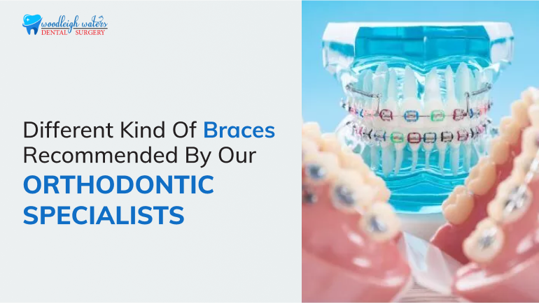 Types of Braces