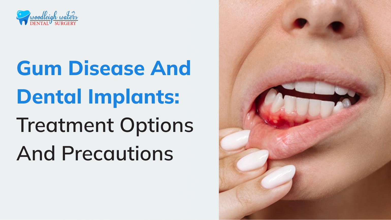 dental implant treatment Berwick