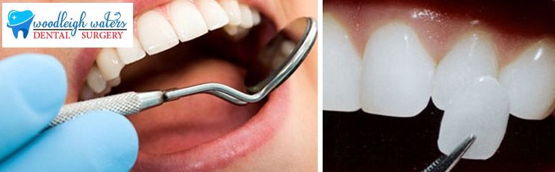 Dentist Clyde Services