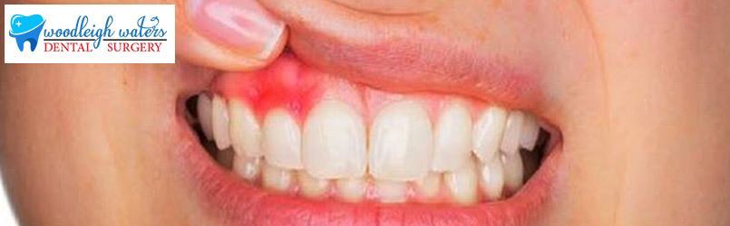 Gum Disease