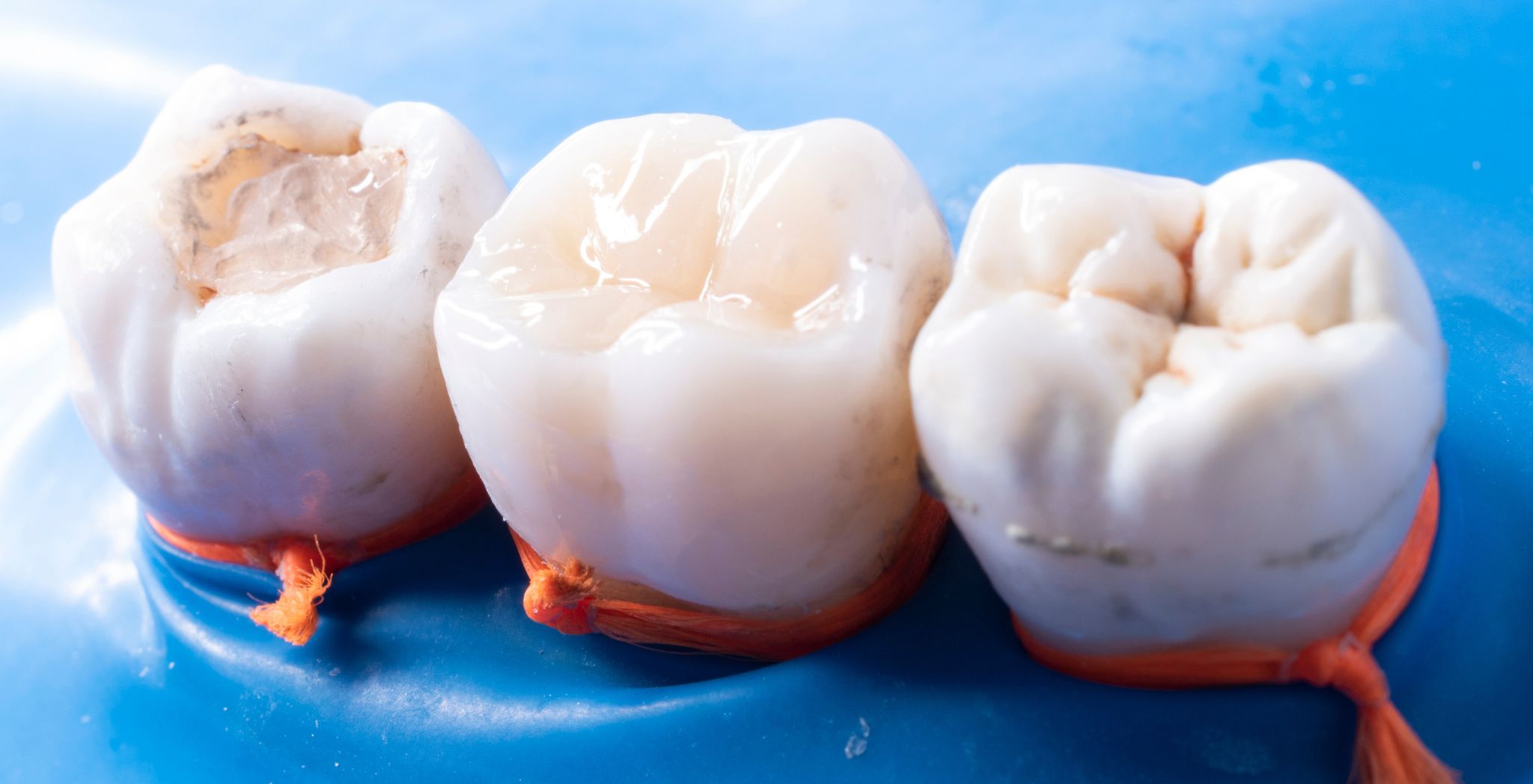 Sensitive Tooth After Filling, Tooth sensitivity after filling, Post-filling tooth pain, Sensitive tooth after dental work, Discomfort after cavity filling, Filling-related tooth sensitivity, Pain after tooth restoration, Tooth hurts after filling