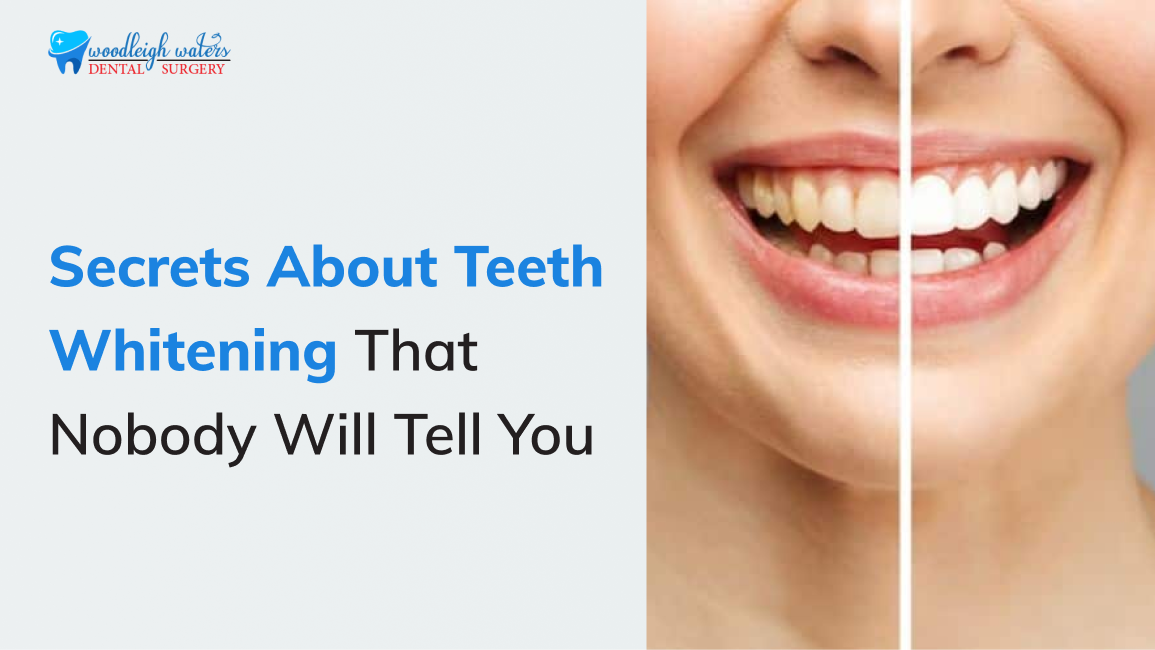 Teeth Whitening Berwick