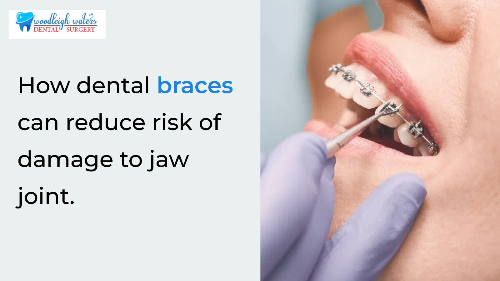 dental braces berwick